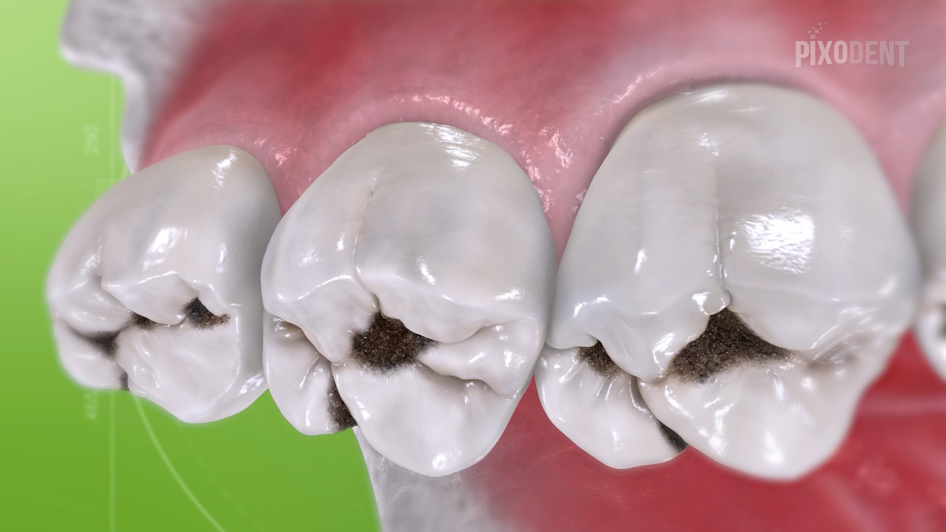 Black Classification