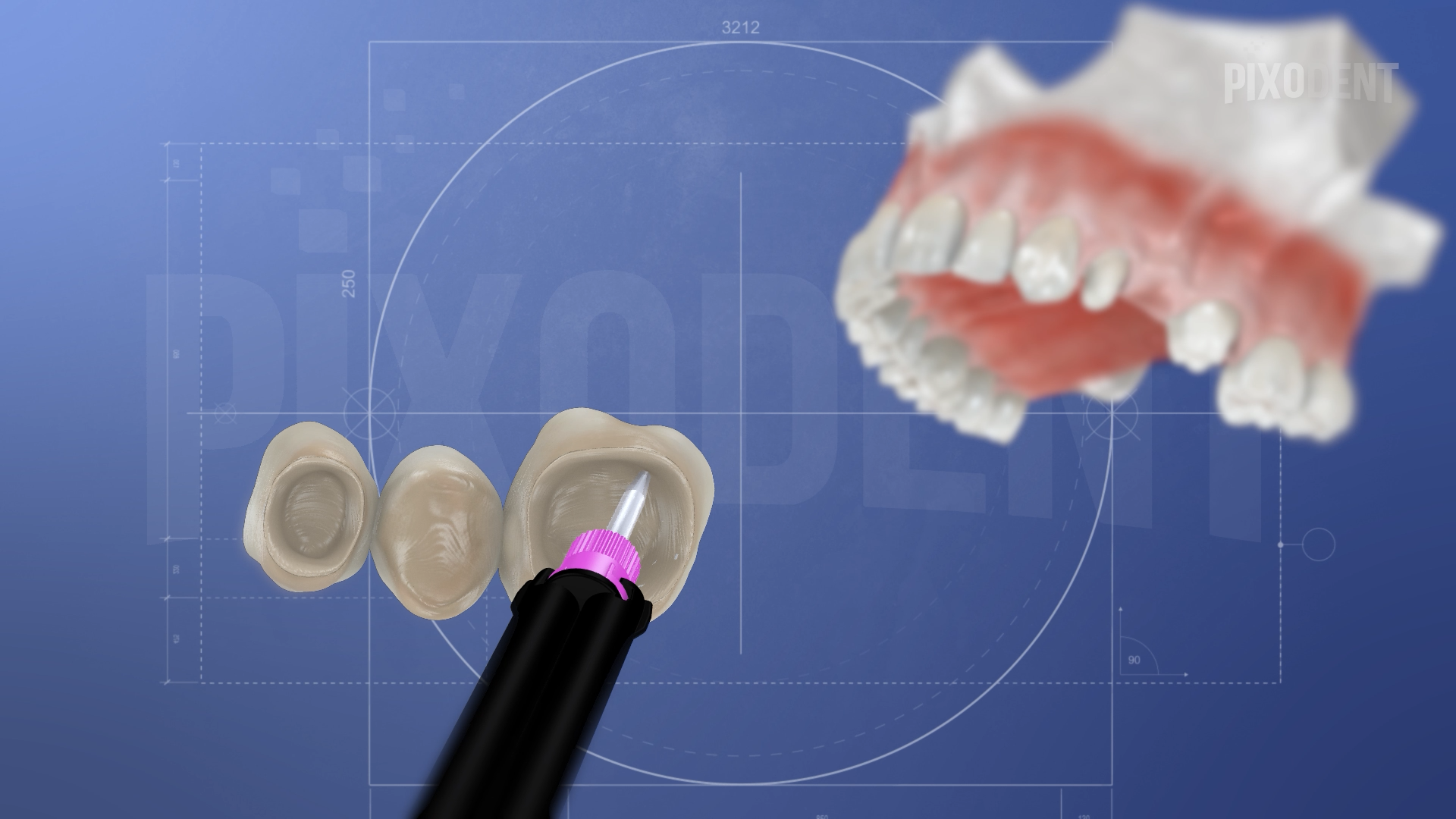 Fixed Prosthodontics