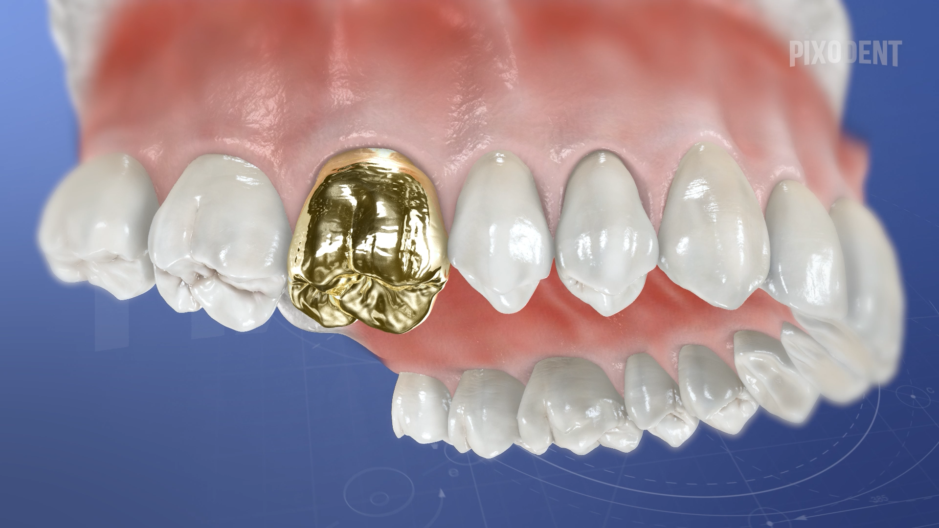 Crown Gold