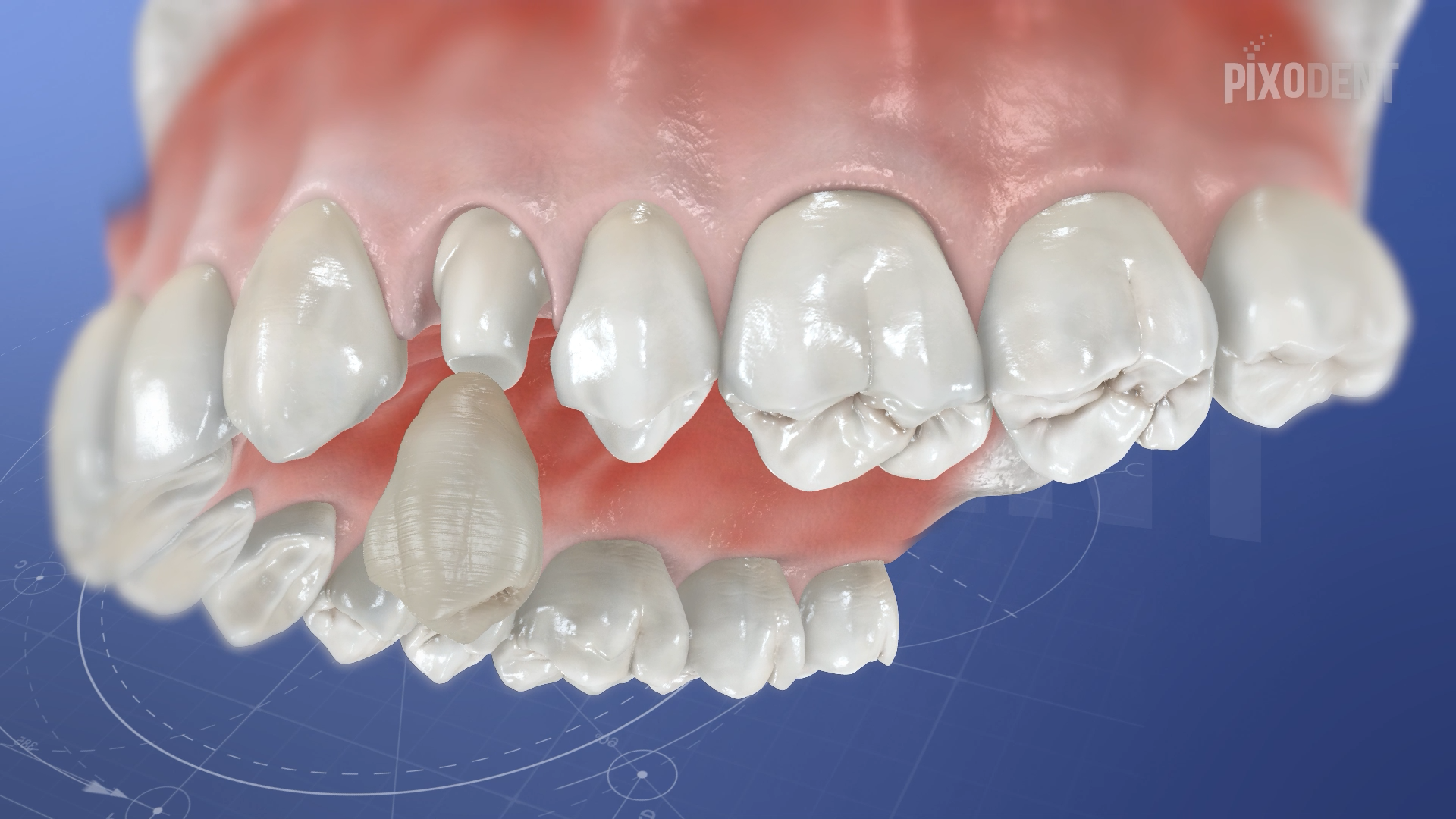 Crown Temporary