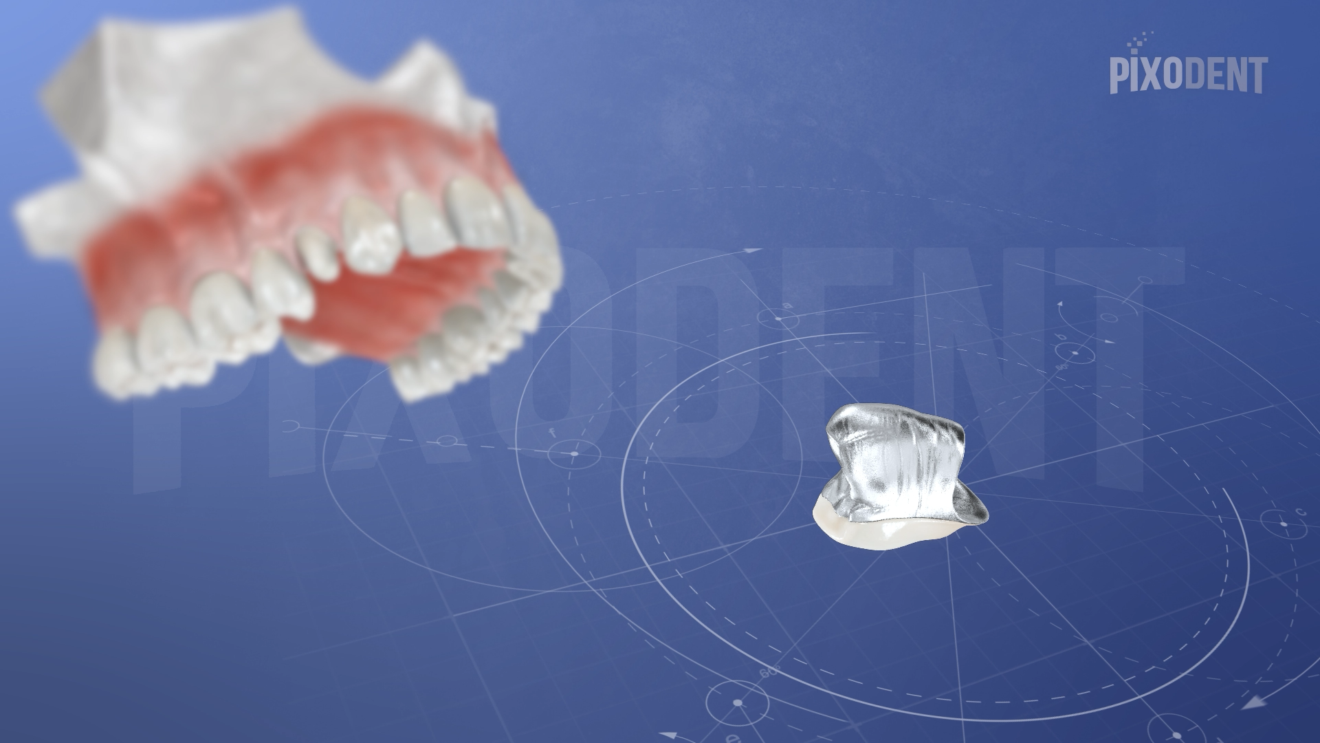 Fixed Prosthodontics