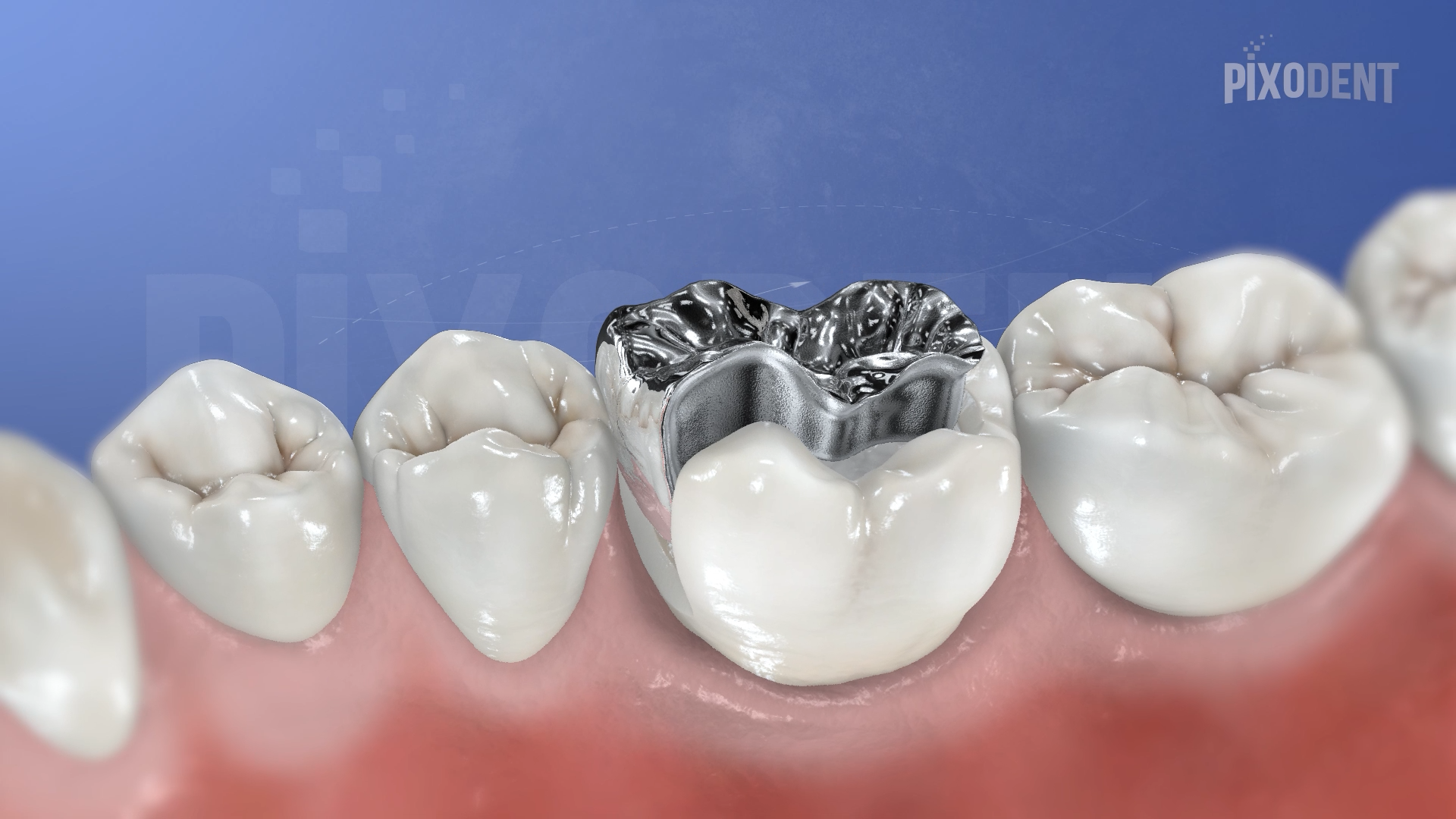 Fixed Prosthodontics