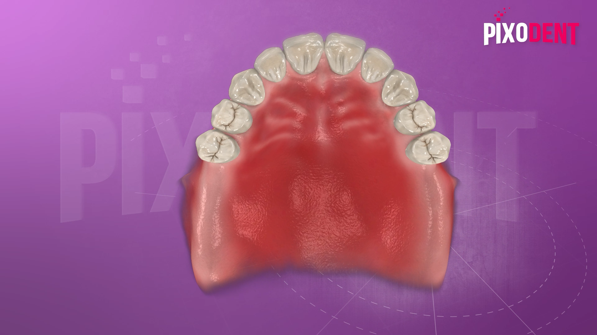 Kennedy Classification