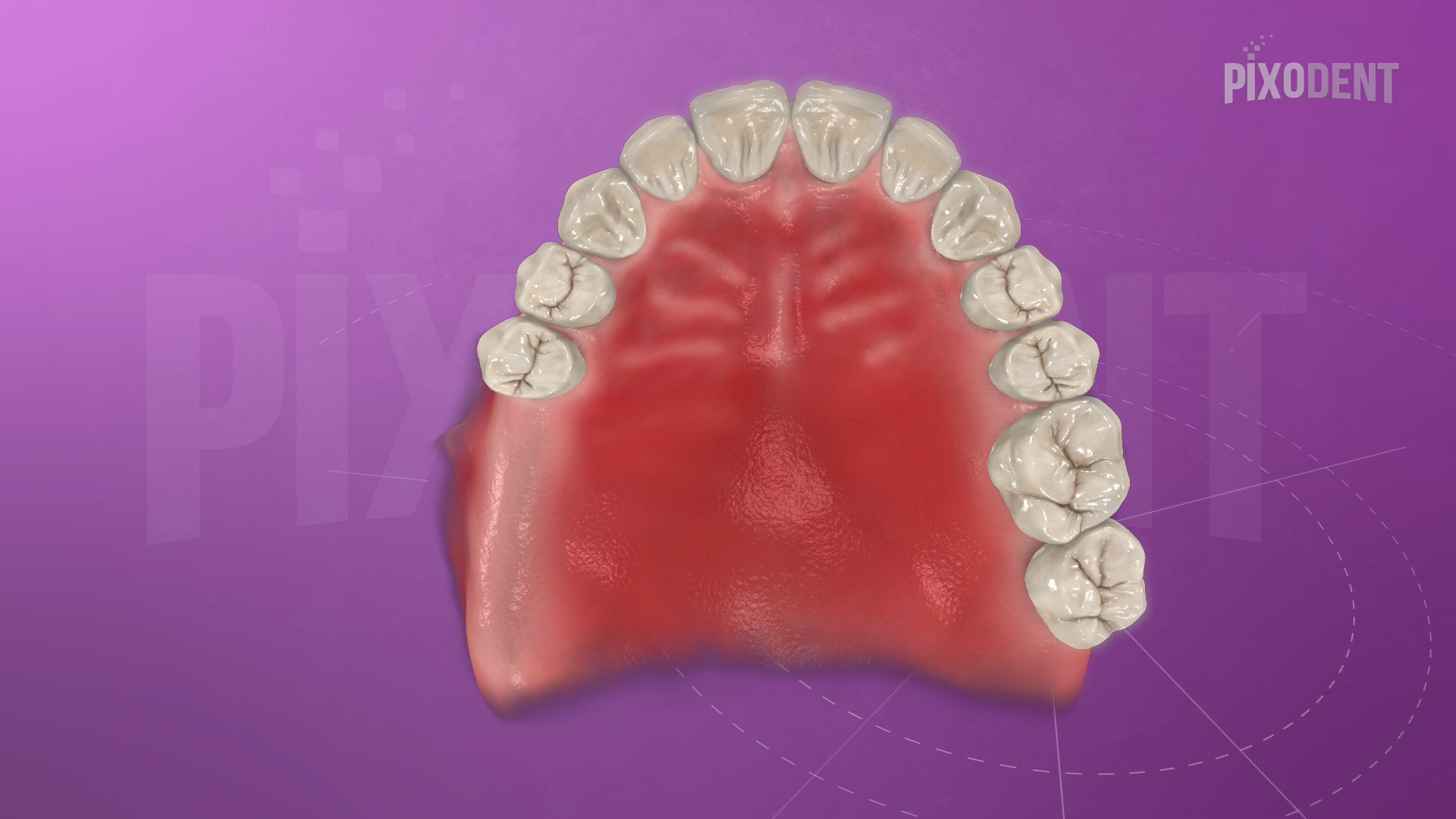 Kennedy Classification