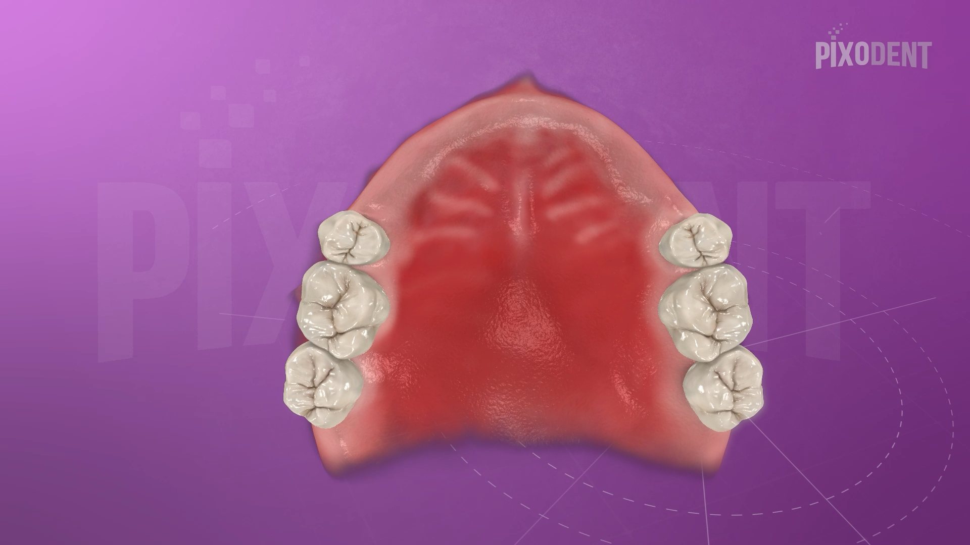Kennedy Classification