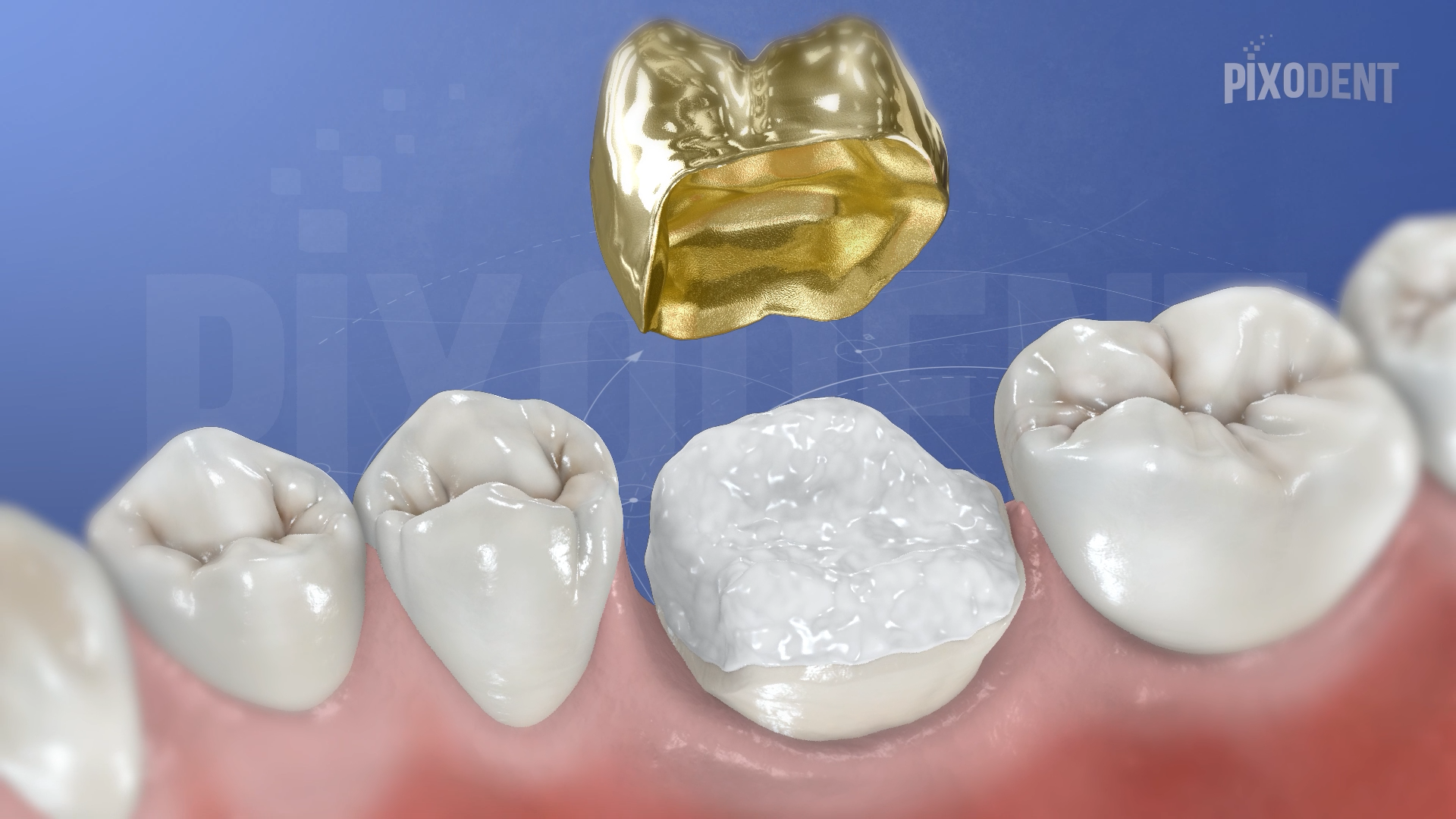Overlay Gold