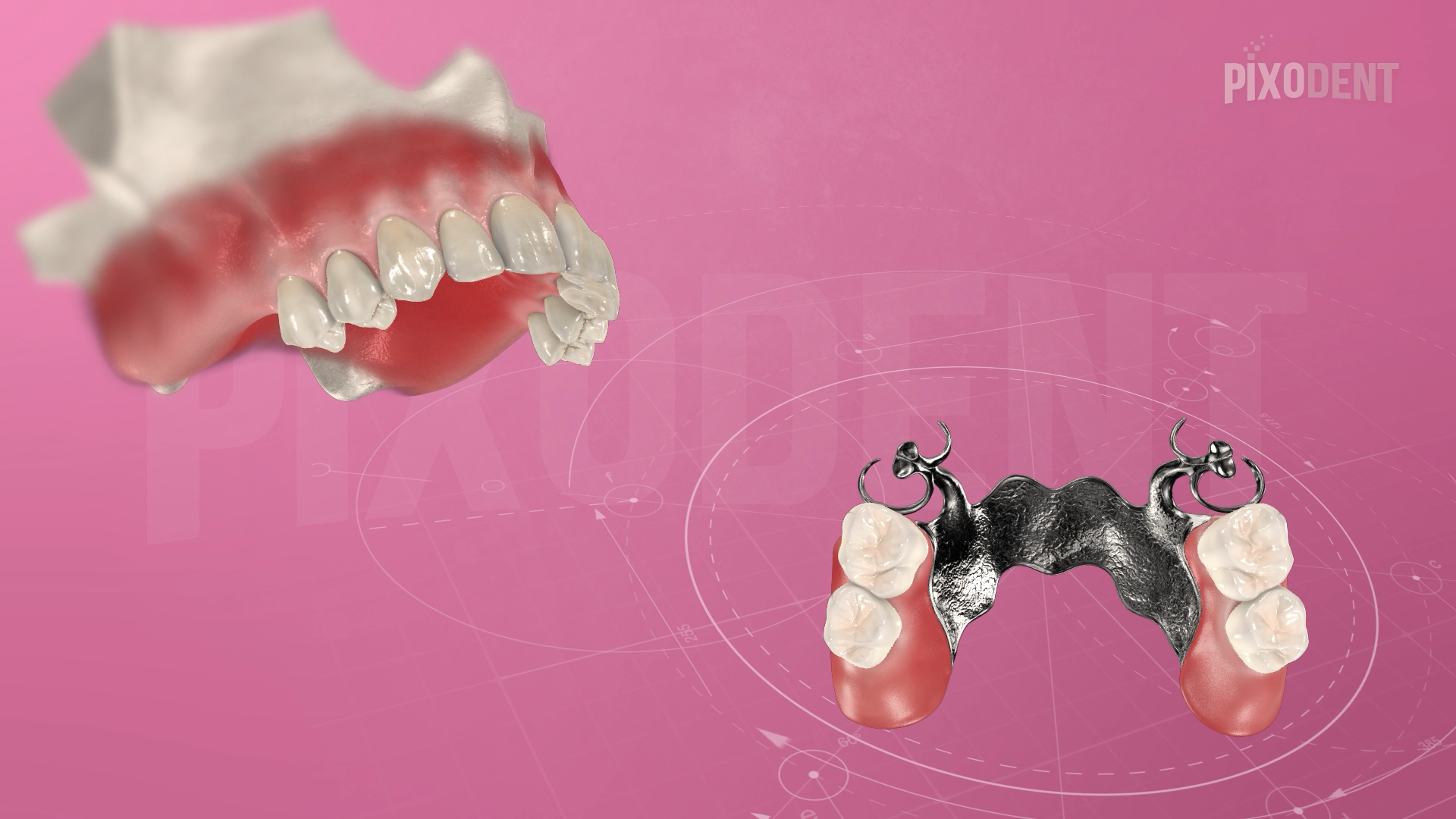 Removable Prosthodontics