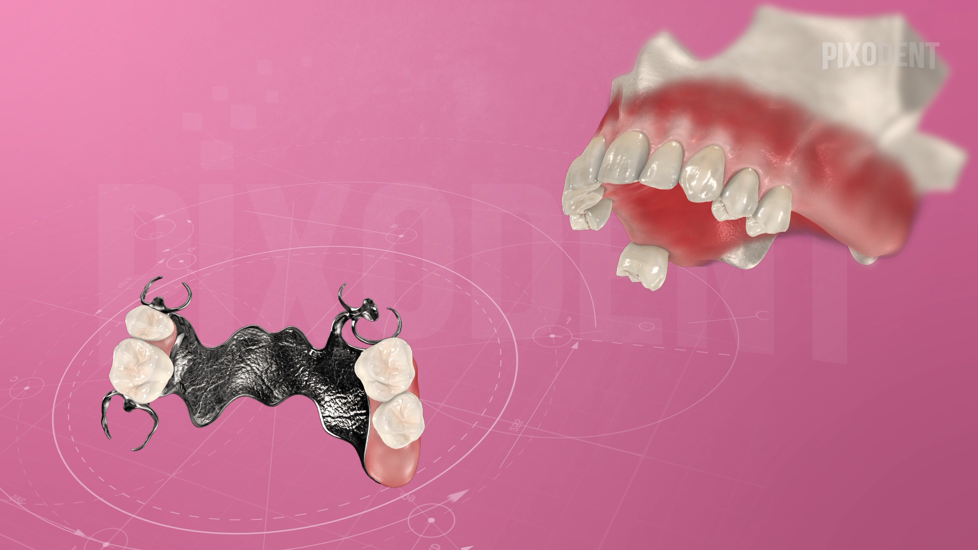 Removable Prosthodontics