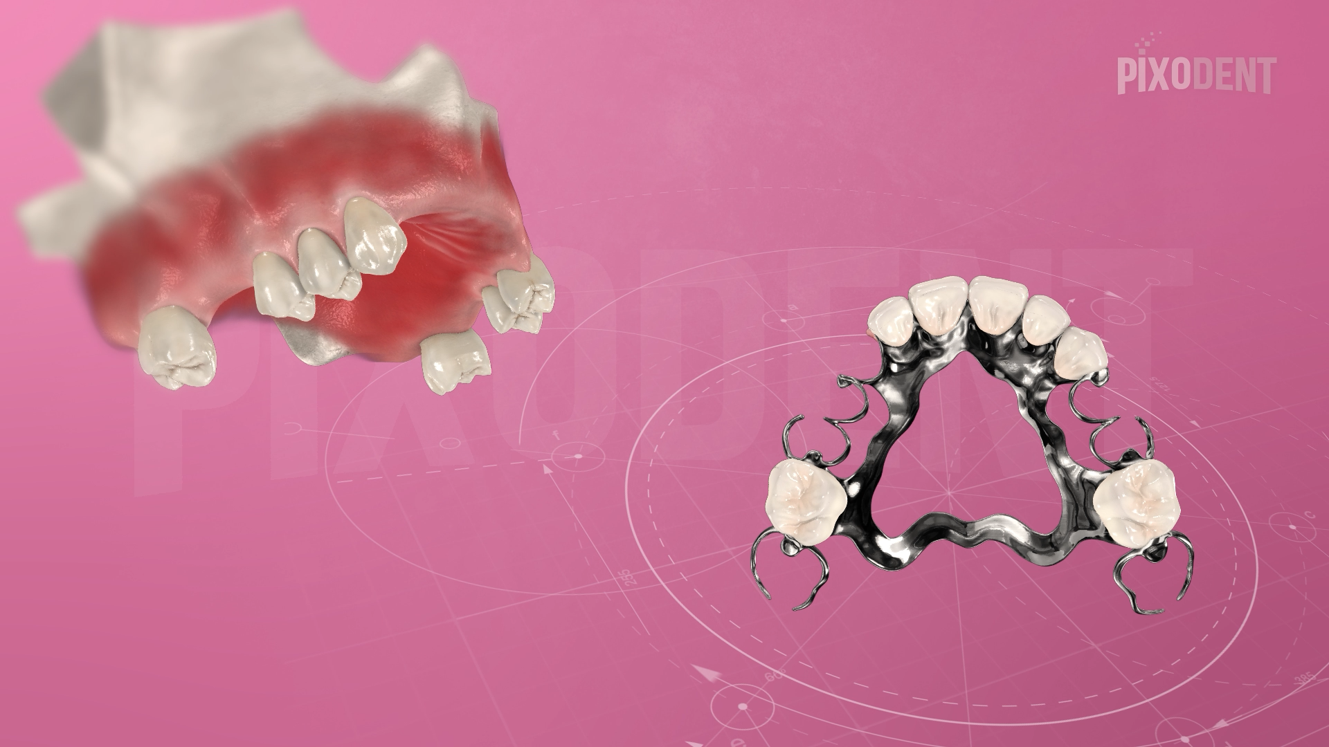 Removable Prosthodontics