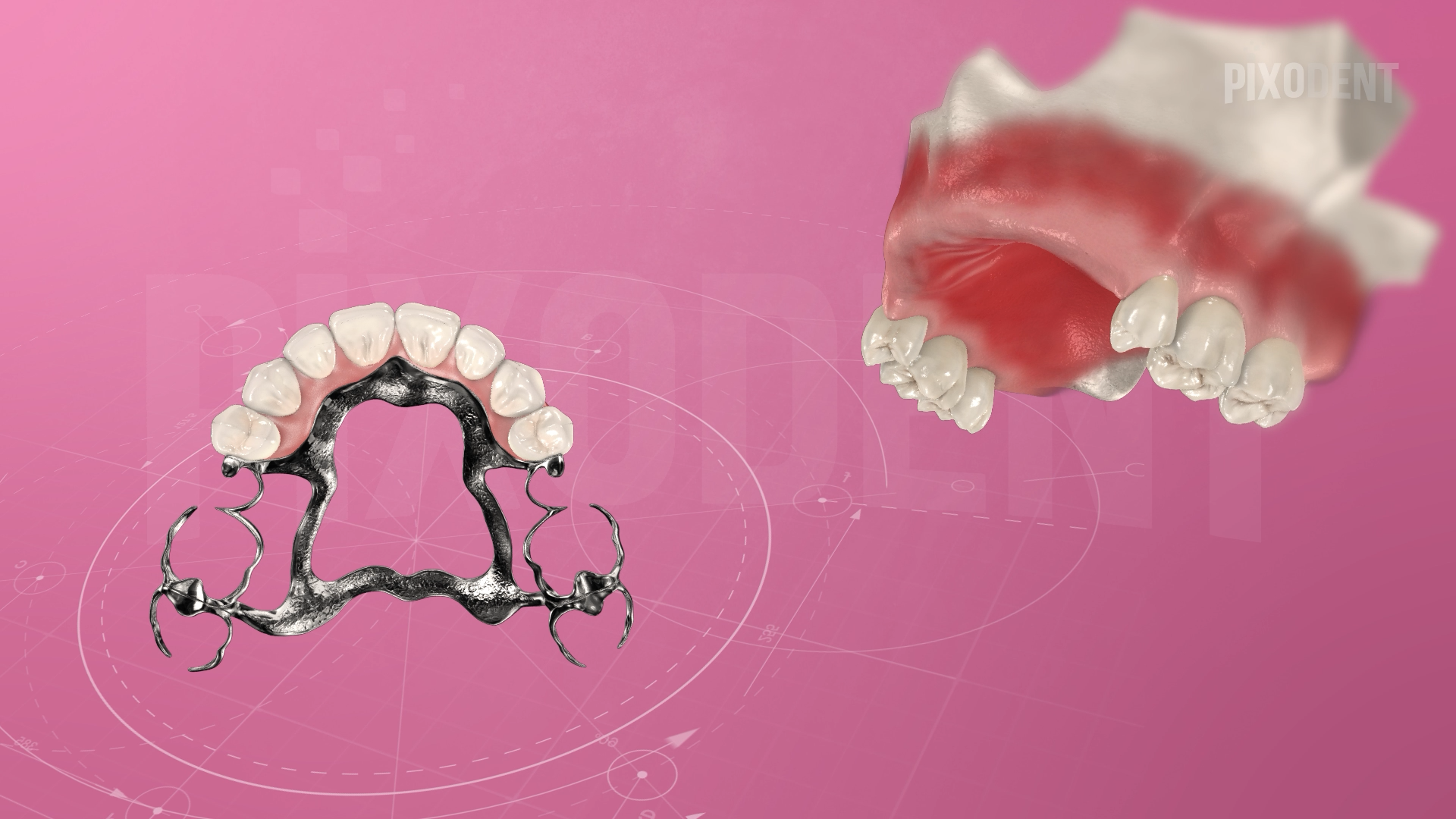 Removable Prosthodontics